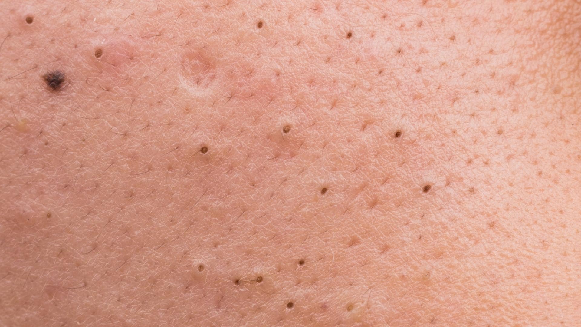 Black Spots & Blackheads On Dog Nipples? (Dangers + Tips)